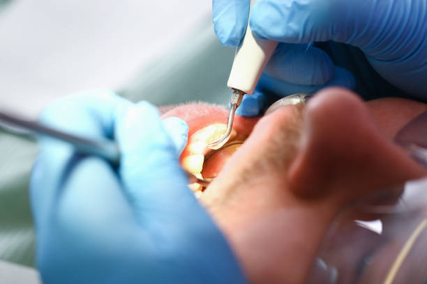 Best Urgent Dental Care for Toothache in Saratoga, WY